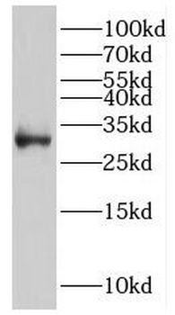 IGFBP7 Rabbit Polyclonal Antibody