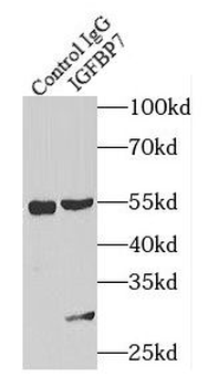 IGFBP7 Rabbit Polyclonal Antibody