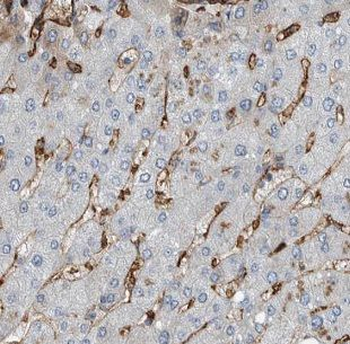 IGFBP7 Rabbit Polyclonal Antibody