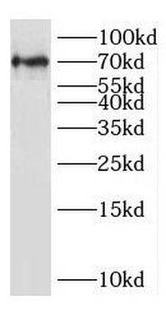 IGSF8 Rabbit Polyclonal Antibody