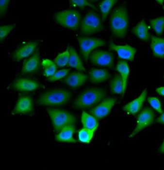 NFKBIB Rabbit Polyclonal Antibody