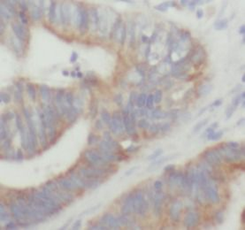 NFKBIB Rabbit Polyclonal Antibody