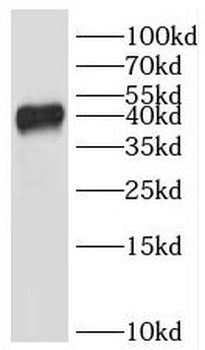 IKBIP Rabbit Polyclonal Antibody