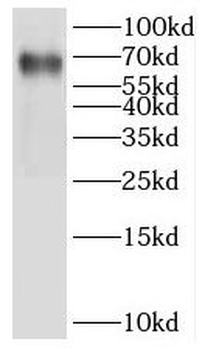 IKZF2 Rabbit Polyclonal Antibody