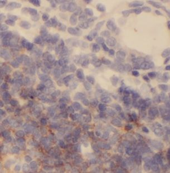 IKZF2 Rabbit Polyclonal Antibody