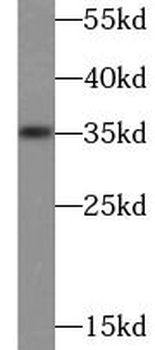 IL1A Rabbit Polyclonal Antibody