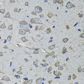 IL1A Rabbit Polyclonal Antibody