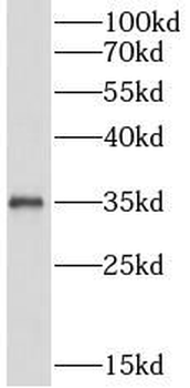 IL1B Mouse Monoclonal Antibody