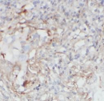 IL1B Mouse Monoclonal Antibody