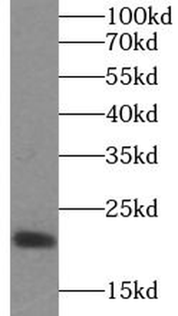 IL10 Mouse Monoclonal Antibody