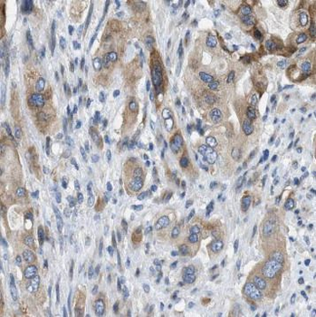 IL10 Mouse Monoclonal Antibody