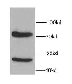 IL10RA Rabbit Polyclonal Antibody