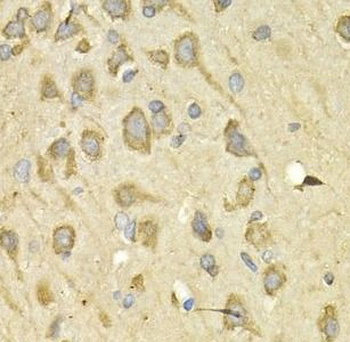 IL10RA Rabbit Polyclonal Antibody