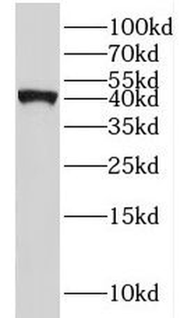 IL10RB Rabbit Polyclonal Antibody