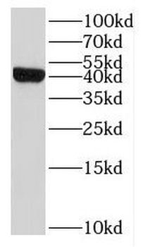 IL10RB Rabbit Polyclonal Antibody