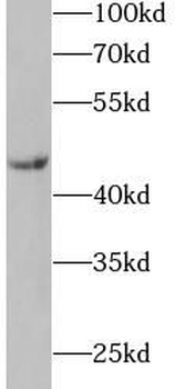 IL11RA Rabbit Polyclonal Antibody