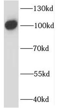 IL12RB1 Rabbit Polyclonal Antibody