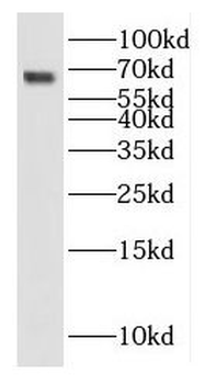 IL13RA2 Rabbit Polyclonal Antibody
