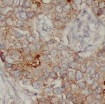 IL13RA2 Rabbit Polyclonal Antibody