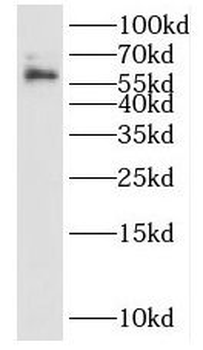 IL15RA Rabbit Polyclonal Antibody