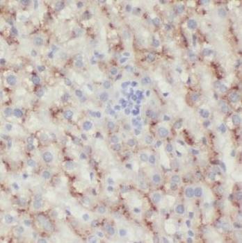 IL15RA Rabbit Polyclonal Antibody
