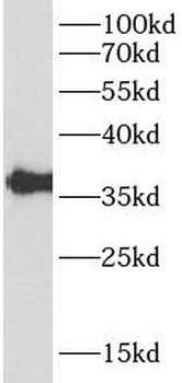 IL16 Mouse Monoclonal Antibody
