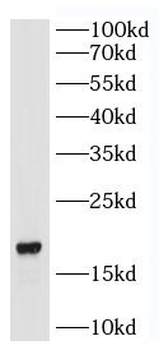 IL17A Rabbit Polyclonal Antibody