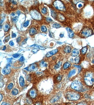 IL17A Rabbit Polyclonal Antibody