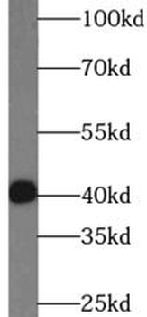 IL17F Mouse Monoclonal Antibody