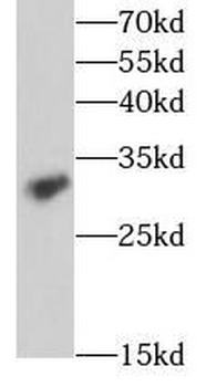 IL17RB Rabbit Polyclonal Antibody