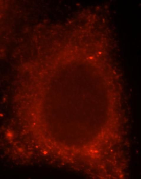 IL17RB Rabbit Polyclonal Antibody