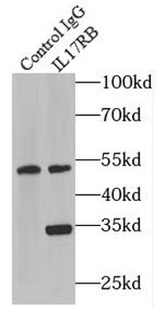 IL17RB Rabbit Polyclonal Antibody