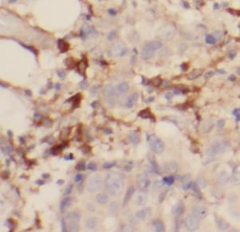 IL17RB Rabbit Polyclonal Antibody