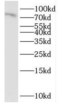IL17RE Rabbit Polyclonal Antibody
