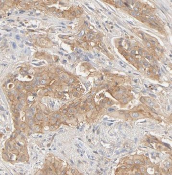 IL17RE Rabbit Polyclonal Antibody