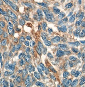 IL19 Rabbit Polyclonal Antibody