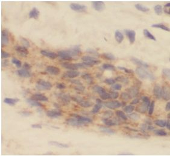IL19 Rabbit Polyclonal Antibody