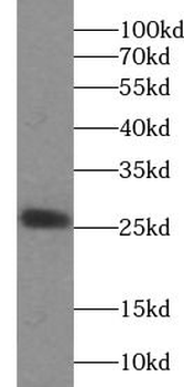 IL1RN Rabbit Polyclonal Antibody