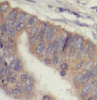 IL1RN Rabbit Polyclonal Antibody