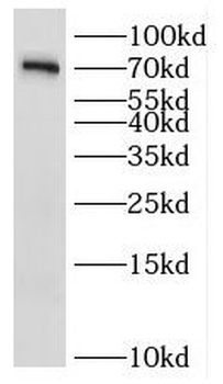 IL1RAPL1 Rabbit Polyclonal Antibody