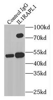IL1RAPL1 Rabbit Polyclonal Antibody