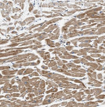 IL1RAPL1 Rabbit Polyclonal Antibody