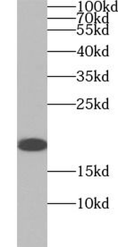 IL2 Mouse Monoclonal Antibody