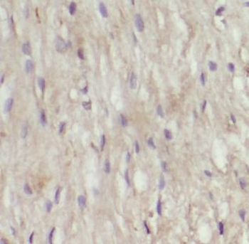 IL2 Mouse Monoclonal Antibody