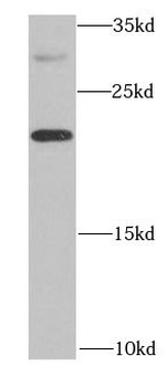 IL20 Rabbit Polyclonal Antibody