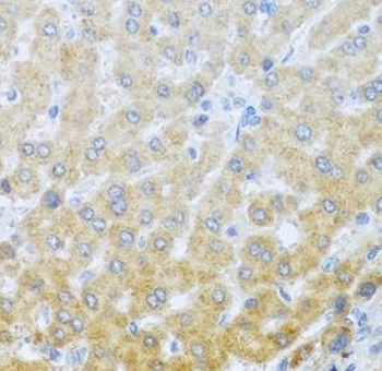 IL20 Rabbit Polyclonal Antibody