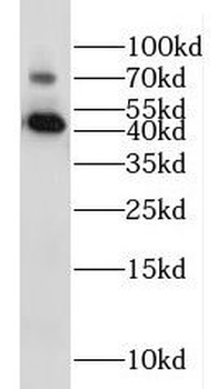 IL20RB Rabbit Polyclonal Antibody
