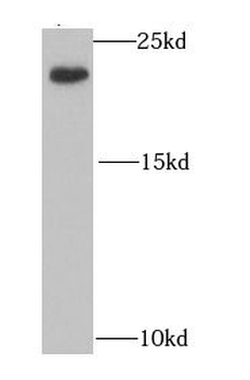 IL21 Rabbit Polyclonal Antibody
