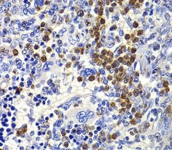 IL21 Rabbit Polyclonal Antibody