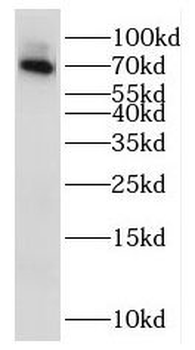 IL21R Rabbit Polyclonal Antibody